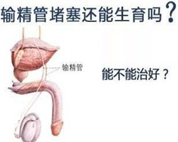 输精管堵塞治疗费用